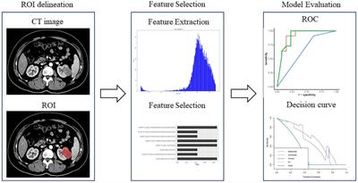 CT−based radiomics signature for differentiating pyelocaliceal upper urinary tract urothelial carcinoma from infiltrative renal cell carcinoma